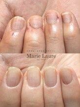 マリーロール 淀屋橋本店(Marie Laure)/自爪育成/深爪矯正/ネイルケア
