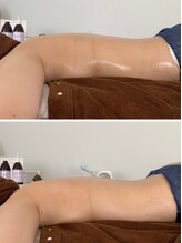 フィール(feel)/Before/After リンパマッサージ