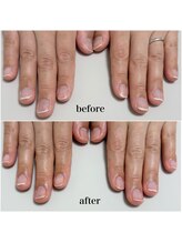 ニカ(Nica)/【自爪育成】お試しケア