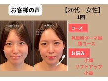 はる鍼灸整骨院