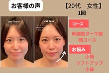 はる鍼灸整骨院