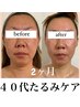 【たるみ・シワ・ハリ・弾力】エラスチン極上オールハンドフェイシャル！