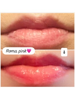 モモン シャルール/ローマピンクbefore & after 