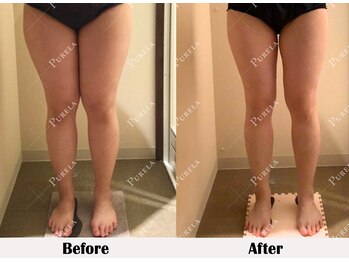 ピュアラ 三宮店/脚ラインの変化が一目で！