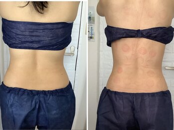 ビューティフルムーン(Beautiful Moon)/冷却一撃コース