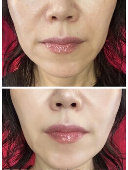 ラシクビューティールーム/光フォト