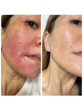 パリライム(parislime)/