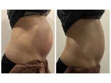 ページミューの雰囲気（腸もみで長年のお悩み解決しませんか？）