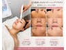 人気No.3☆【透き通る白玉美肌輝く肌】毛穴洗浄+白玉ピコトーニング+プラズマ