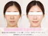 美白・色ムラ・シミ 話題のミルクライトxLDM で叶える、究極の白玉水光肌へ