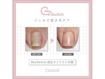 ピクシスネイル(pyxis nail)/