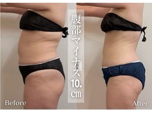 シューラディアント(ShuRadiant)/ぽっこりお腹撃退！