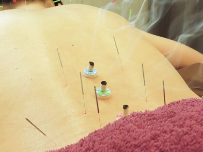 所沢鍼灸整体院の写真