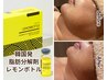 【レモンボトル】小顔脂肪分解♪リバウンド・ダウンタイムなし◎通常12100円