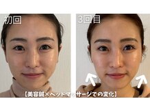 鍼灸サロン アヤカ(AYAKA)/美容鍼×ヘッドマッサージ◎