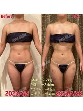 アユスリム(AYU SLIM)/短期集中ケア　充実痩身♪