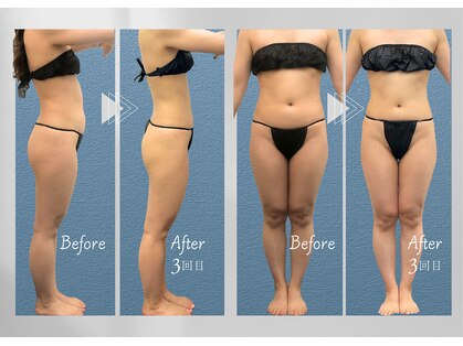 スクエア サロン(Square Salon)の写真