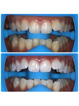 コナホワイトニング 神保町/セルフホワイトニング神保町