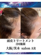 メンズサロンアール(AR)/プロセルセラピーズ