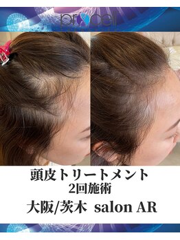 メンズサロンアール(AR)/プロセルセラピーズ
