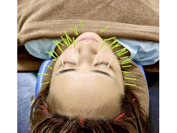 マリモ鍼灸接骨院