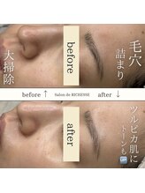 サロンドリシェス(Salon de RICHESSE)/オプション追加で毛穴詰まり改善