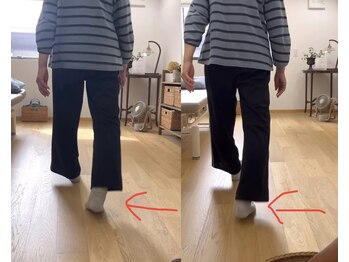 ランドル(rendre)/数年前から膝が痛い