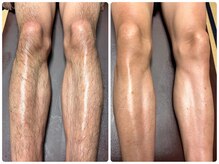 コルリース(COL Riys)/メンズ両足ワックス6,600円