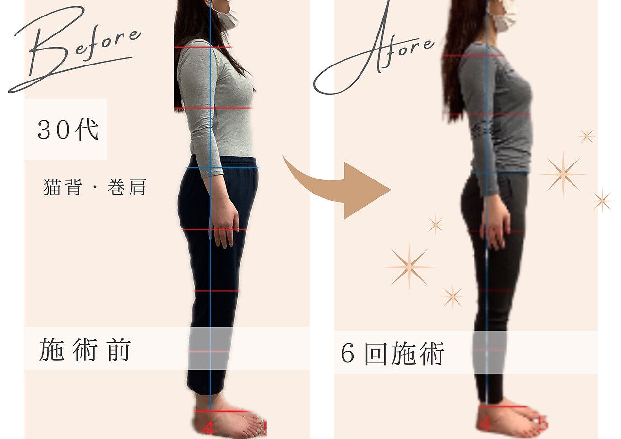 梅田・大阪梅田駅でEMSが人気のエステサロン｜ホットペッパービューティー