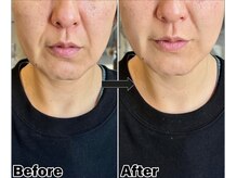 整顔院 学芸大学店/