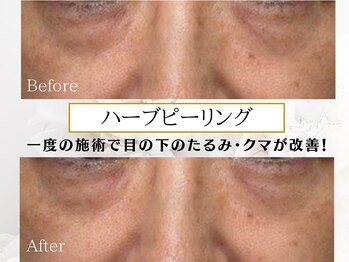 プリンセスフォー/ビフォーアフター☆