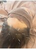 【頭皮鍼】 極上頭かっさヘッドスパ＆カッピング +経絡頭皮鍼70分