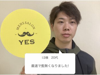 イエス 大阪梅田店(YES)/最速で髭無くなりました!