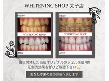 ホワイトニングショップ 太子店の雰囲気（独自開発したオリジナルのジェルを使用!本来の歯の色をゲット♪）