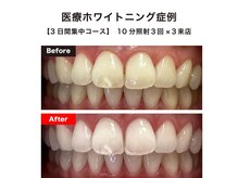 ハイティース 高田馬場店(Hi Teeth!)の雰囲気（医療提携ジェルだから効果が高い！短期集中プランも有り♪）