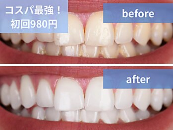 ボディアーキ 松山店(BODY ARCHI)/