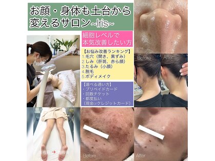 イリス(Iris)の写真