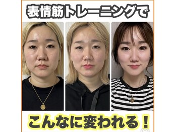 アランチャンティック(AlamCantik)の写真/【お顔のタイトニングで憧れの美小顔に♪】《エイジングケア×コラーゲン生成》の新マシン導入サロン♪