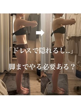 プラスイチド/下半身も痩せるブライダル