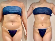 カルナ(CARNA)の雰囲気（最後のダイエットセルゼロ2！詳しくはブログへ/痩身、毛穴）