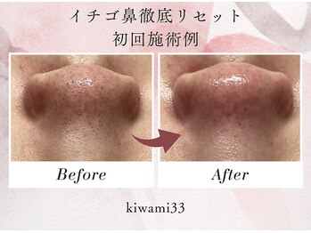 キワミ サーティスリー(kiwami33)/