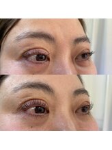 アイラッシュサロン ナチュレ 新河岸店(NATURE)/上下パリジェンヌ