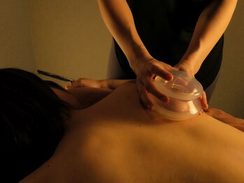 スパ タンネン(SPA TAN-NEN)/【OP4】カッピング