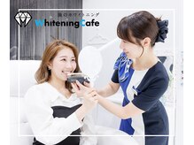 ホワイトニングカフェ 郡山店/トーンチェック/ホワイトニング