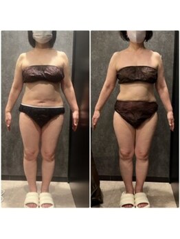 フローボディ 新山口店(flow BODY)/山口のエステはflow BODY