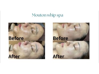 アロマサロン ココル(cocoru)/ビフォーアフター