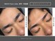 メンズフェイスラボ 本町 阿波座(MEN'S Face Labo)の写真