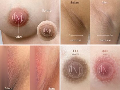 エルビービュティーサロン(LB BEAUTY SALON)の写真