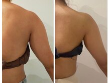 ルナグランデ(Luna grande.)/効果写真