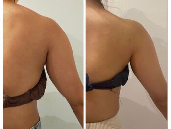 ルナグランデ(Luna grande.)/効果写真